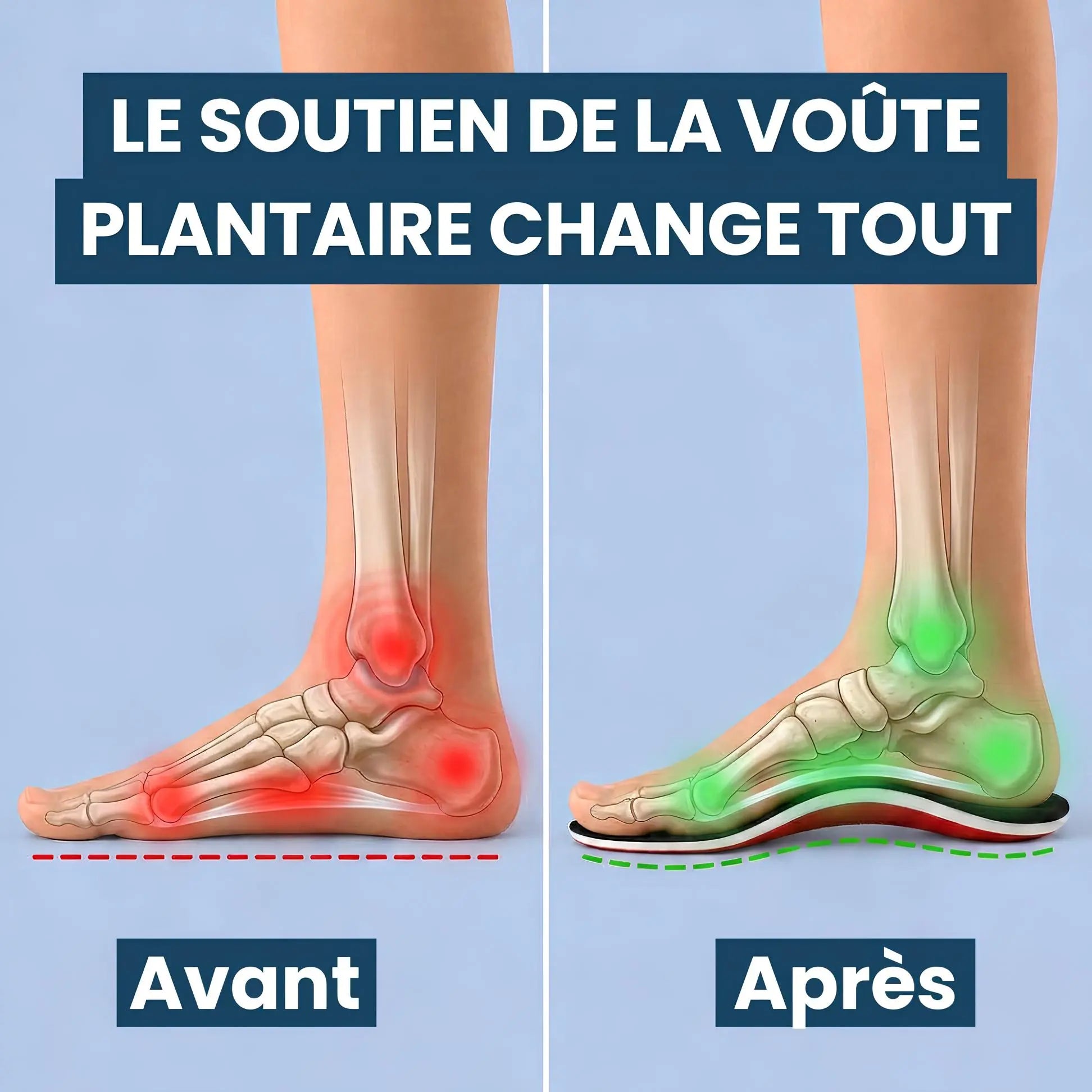 IVVERA™| Semelles de Soutien de la Voûte Plantaire